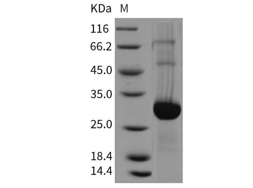 Recombinant Mouse GLIPR1 Protein (His Tag) - ABMIUM