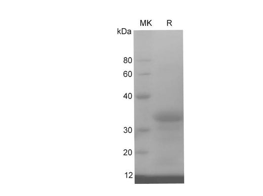 SDS-PAGE analysis of Human BMPR2 proteins, 2 μg/lane of Recombinant Human BMPR2 proteins was resolved with SDS-PAGE under reducing conditions, showing bands at 35 kDa.