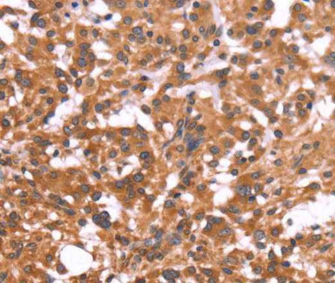 Anti-Human CRISP3 Antibody