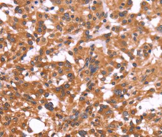 Anti-Human CRISP3 Antibody