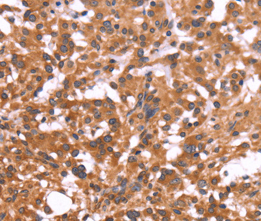 Anti-Human CRISP3 Antibody - ABMIUM