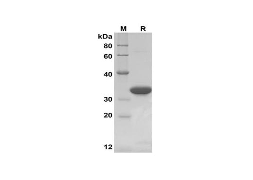 SDS-PAGE analysis of Rat IFN-γ proteins,2 μg/lane of Recombinant Rat IFN-γ proteins,was resolved with SDS-PAGE under reducing conditions,showing bands at 32 kDa.