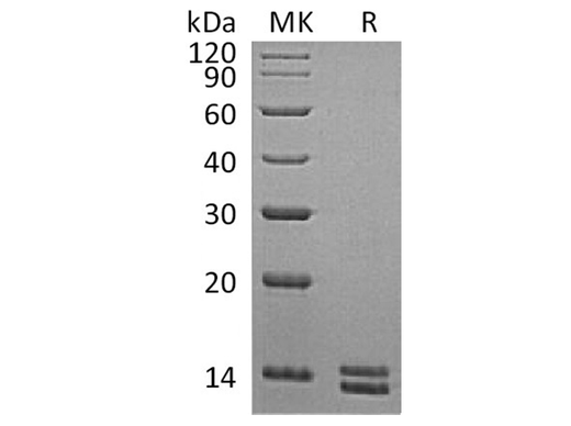Recombinant Human S100A8&S100A9 Heterodimer Protein (His Tag) - ABMIUM