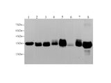 Anti-Human/Mouse/Rat LDHA Antibody - ABMIUM
