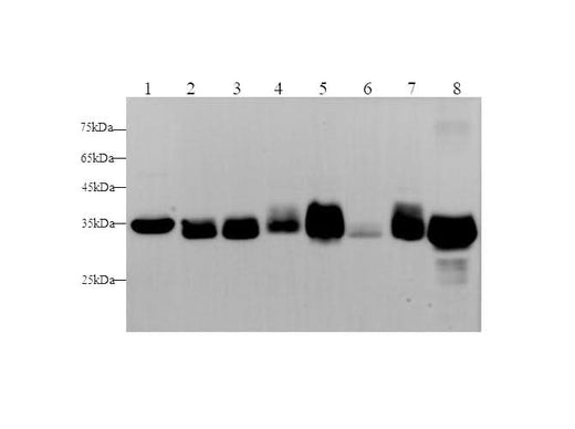 Anti-Human/Mouse/Rat LDHA Antibody - ABMIUM
