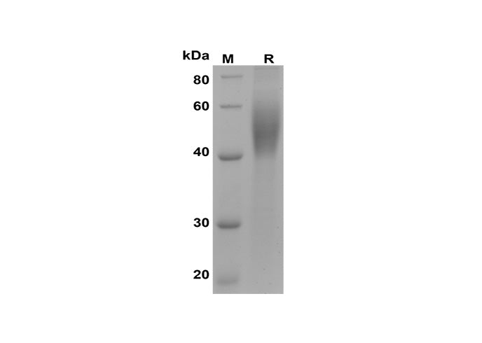 SDS-PAGE analysis of Human CD200R proteins, 2 μg/lane of Recombinant Human CD200R proteins was resolved with SDS-PAGE under reducing conditions, showing bands at 40-60 kDa.