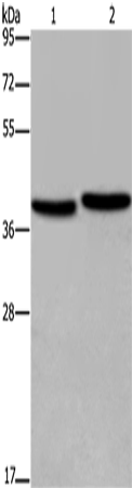 Anti-Human/Mouse/Rat FHL1 Antibody - ABMIUM