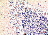 Immunohistochemistry of paraffin-embedded Human brain tissue using MAP1LC3B Monoclonal Antibody at dilution of 1:200.