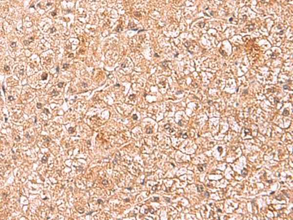 Anti-Human/Mouse ASTN2 Antibody
