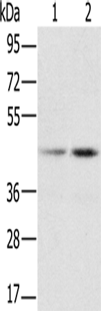 Anti-Human/Mouse/Rat hnRNP G Antibody - ABMIUM