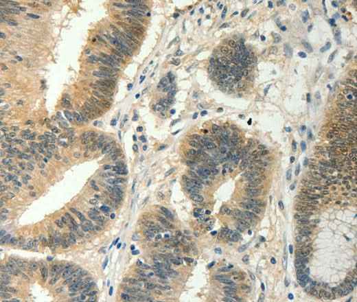 Anti-Human/Mouse SOCS5 Antibody