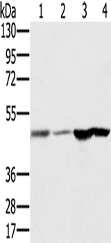 Anti-Human RNH1 Antibody - ABMIUM