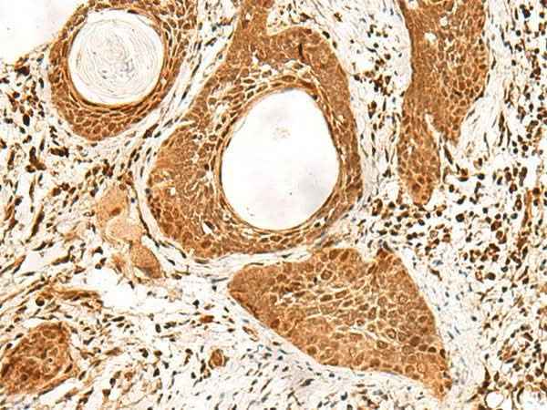 Anti-Human/Mouse/Rat ADRM1 Antibody