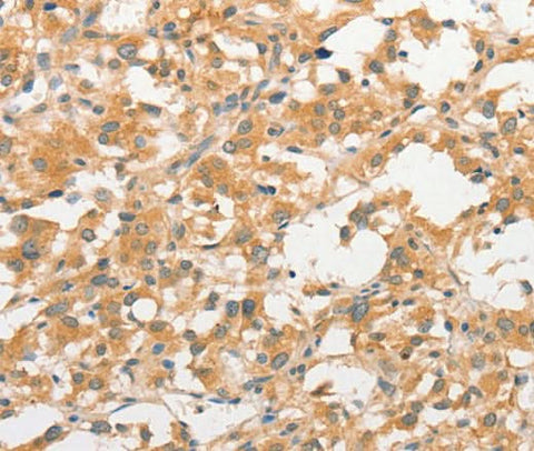 Anti-Human TLR3 Antibody - ABMIUM