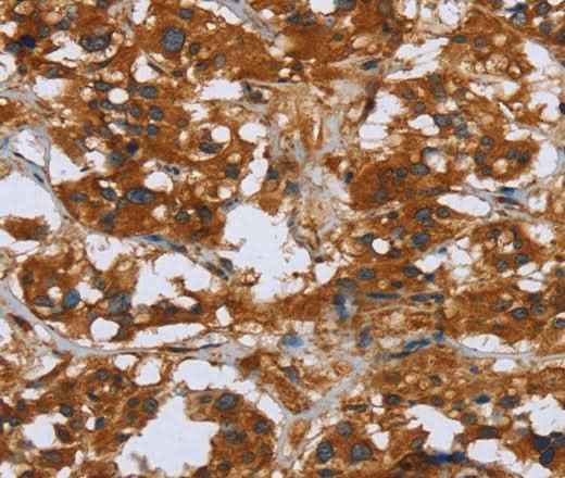 Anti-Human/Mouse/Rat COMP Antibody