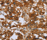 Anti-Human/Mouse/Rat COMP Antibody - ABMIUM