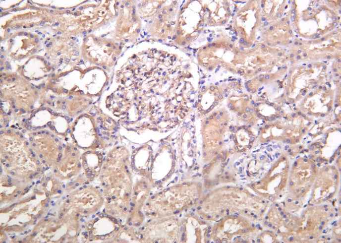 Anti-Human/Mouse/Rat MYH9 Antibody [B1053]
