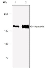 Anti-Rat/Mouse Hamartin Antibody [A773] - ABMIUM