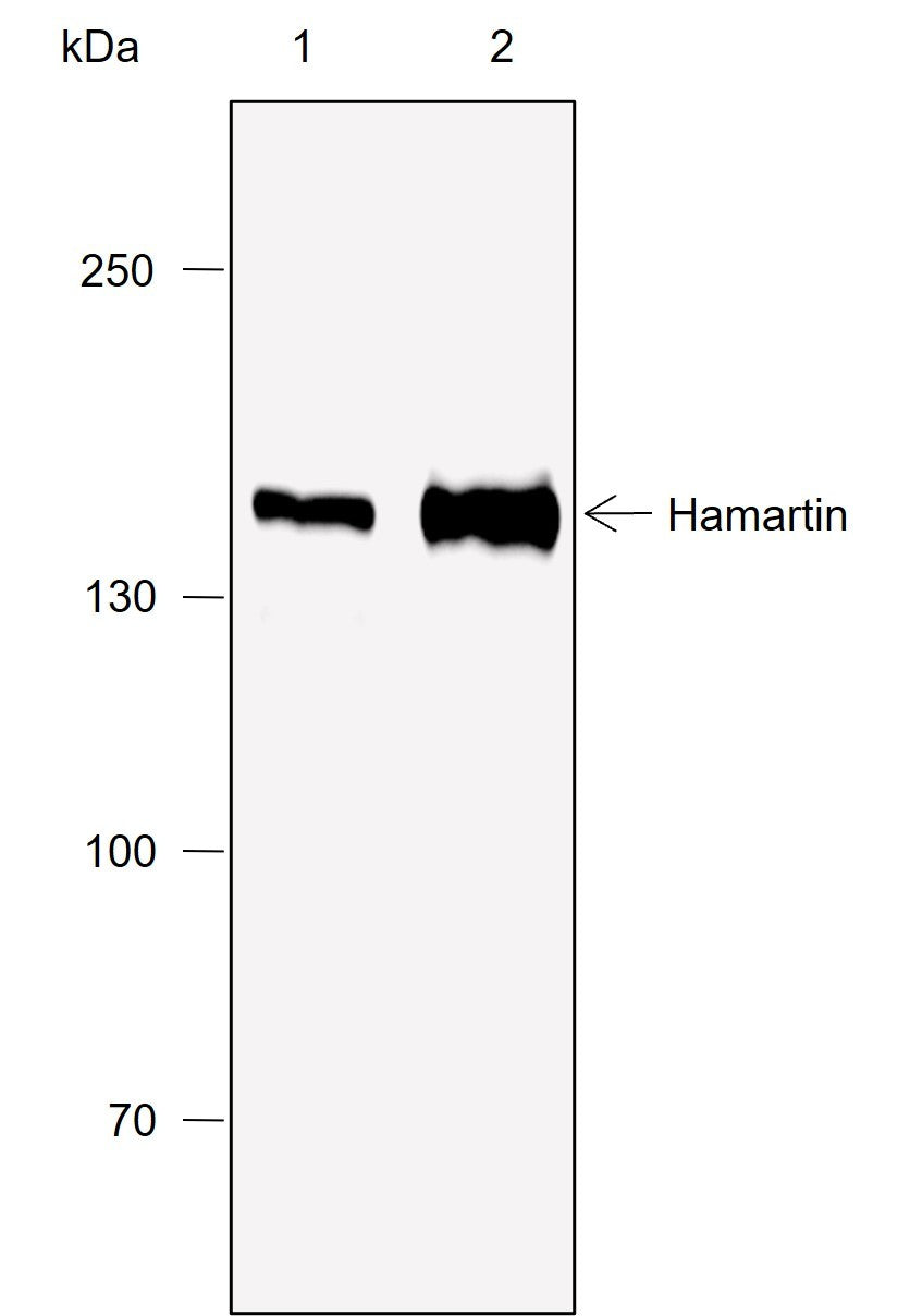 Anti-Rat/Mouse Hamartin Antibody [A773] - ABMIUM
