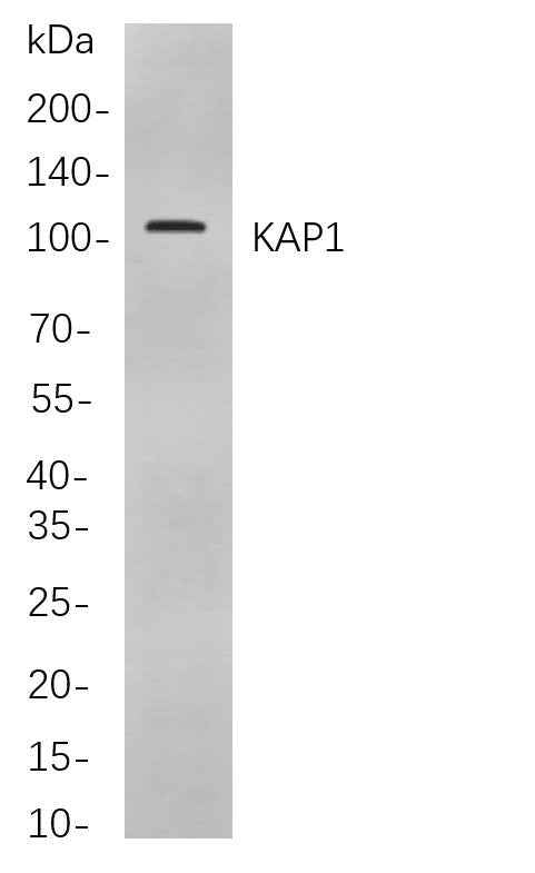 Anti-Human/Mouse/Rat KAP1 Antibody [B744]