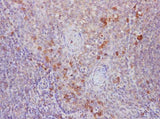 Anti-Human B7-1/CD80 Antibody - ABMIUM