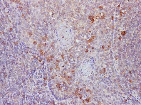 Anti-Human B7-1/CD80 Antibody - ABMIUM