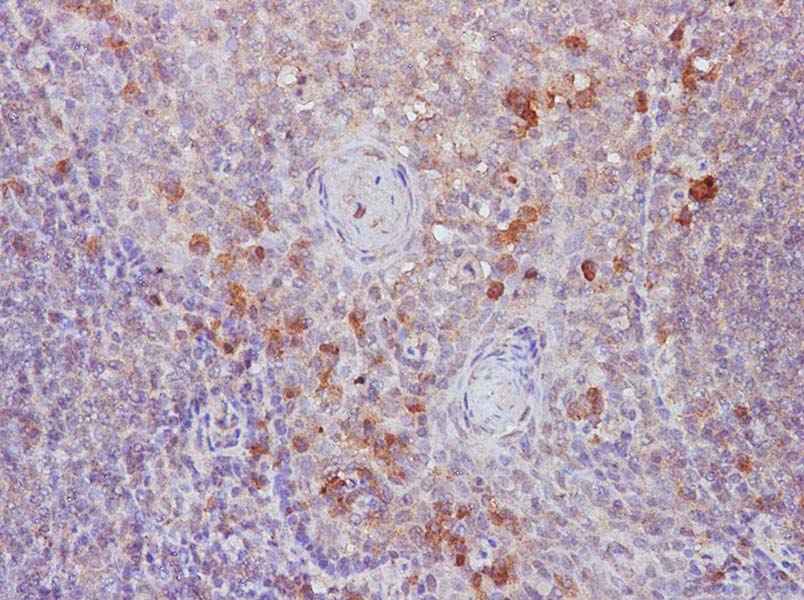 Anti-Human B7-1/CD80 Antibody - ABMIUM
