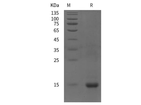 SDS-PAGE analysis of Human SQSTM1/ p62 proteins, 2 μg/lane of Recombinant Human SQSTM1/ p62 proteins was resolved with SDS-PAGE under reducing conditions, showing bands at 15 kDa.