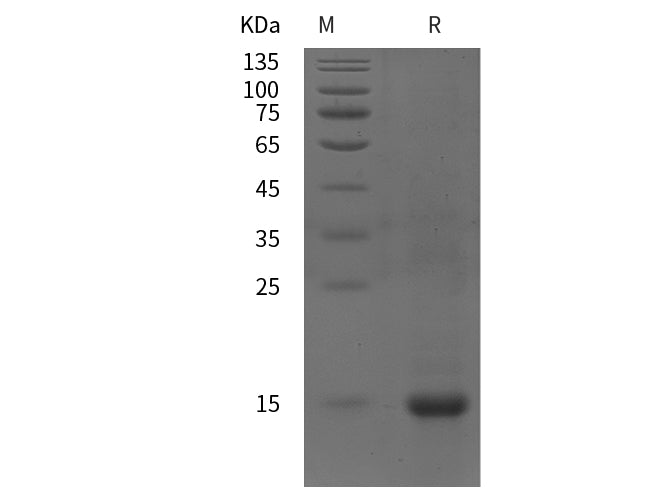 SDS-PAGE analysis of Human SQSTM1/ p62 proteins, 2 μg/lane of Recombinant Human SQSTM1/ p62 proteins was resolved with SDS-PAGE under reducing conditions, showing bands at 15 kDa.