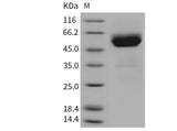 Recombinant Mouse TRAIL R2/TNFRSF10B Protein (His & Fc Tag) - ABMIUM