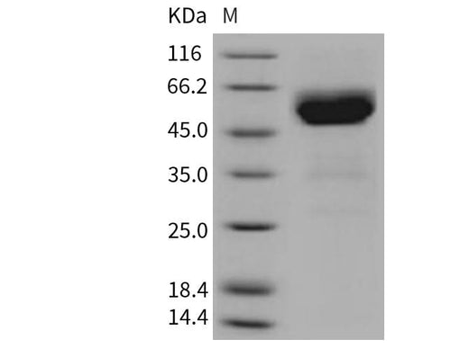 Recombinant Mouse TRAIL R2/TNFRSF10B Protein (His & Fc Tag) - ABMIUM