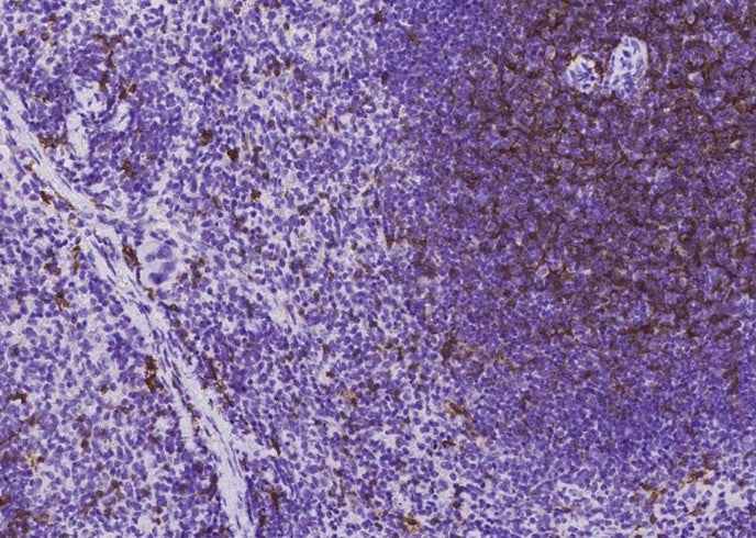 Anti-Mouse CD8A Antibody [B443] - ABMIUM