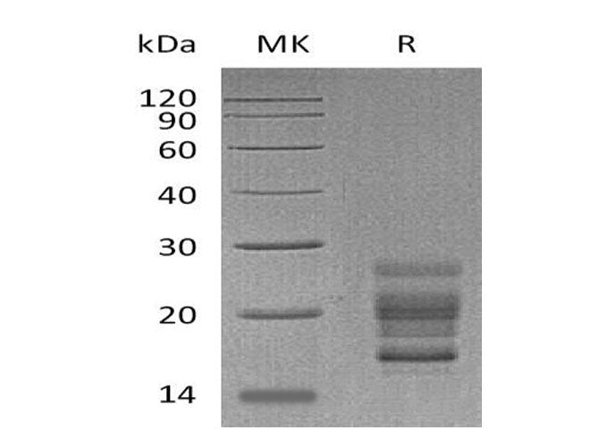 > 95 % as determined by reducing SDS-PAGE.