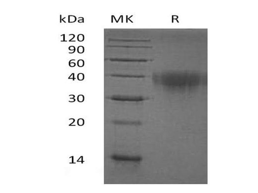 Recombinant Human PD-1/PDCD1 Protein (His Tag) - ABMIUM
