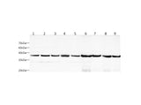 Anti-Human/Mouse/Rat AST Antibody - ABMIUM