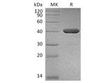 Recombinant Human IDO2 Protein (His Tag) - ABMIUM