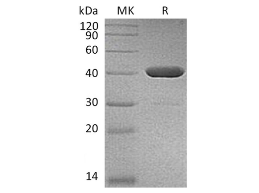 Recombinant Human IDO2 Protein (His Tag) - ABMIUM