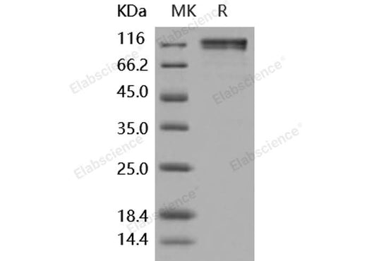 Recombinant Human CD45/PTPRC Protein (Fc Tag) - ABMIUM