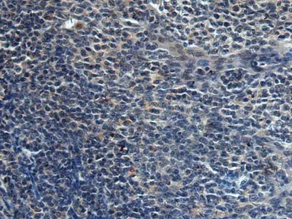 Anti-Human HAUS6 Antibody