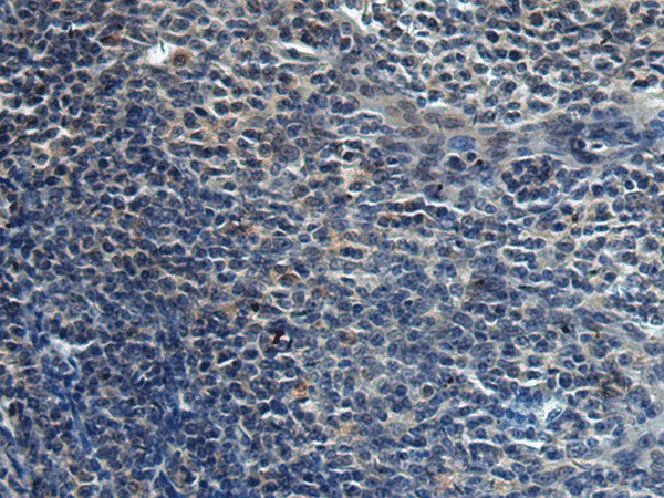 Immunohistochemistry of paraffin-embedded Human tonsil tissue using HAUS6 Polyclonal Antibody at dilution of 1:45(×200)
