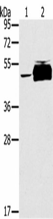 Anti-Human PTPN20 Antibody - ABMIUM