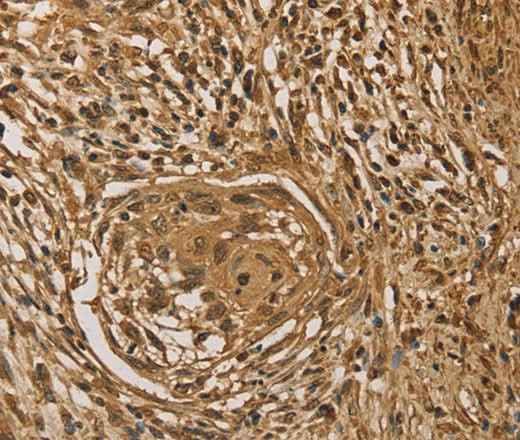 Anti-Human/Mouse PRDM14 Antibody