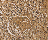 Anti-Human/Mouse PRDM14 Antibody - ABMIUM