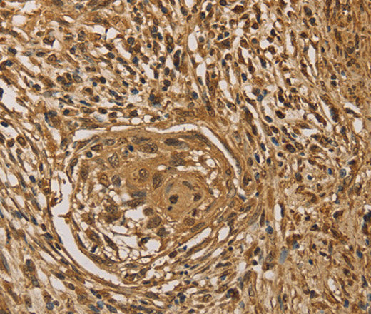 Anti-Human/Mouse PRDM14 Antibody - ABMIUM