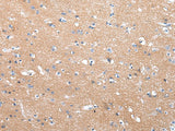 Anti-Human/Mouse/Rat COLEC12 Antibody - ABMIUM