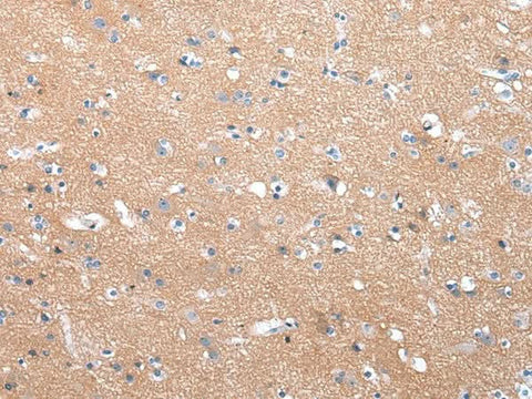 Anti-Human/Mouse/Rat COLEC12 Antibody - ABMIUM