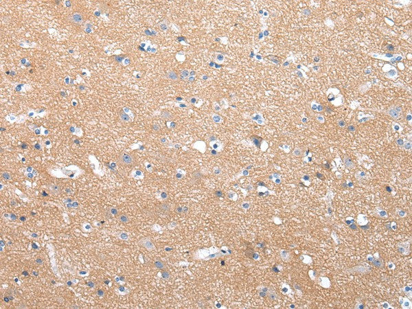 Anti-Human/Mouse/Rat COLEC12 Antibody - ABMIUM