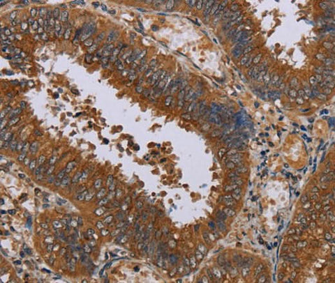 Anti-Human/Mouse/Rat NPTX1 Antibody - ABMIUM
