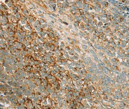 Anti-Human/Mouse/Rat PRKAA1 Antibody
