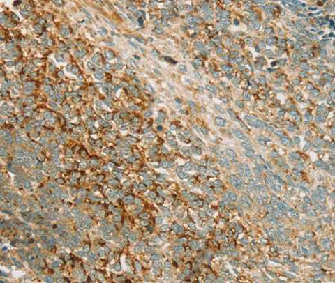 Anti-Human/Mouse/Rat PRKAA1 Antibody